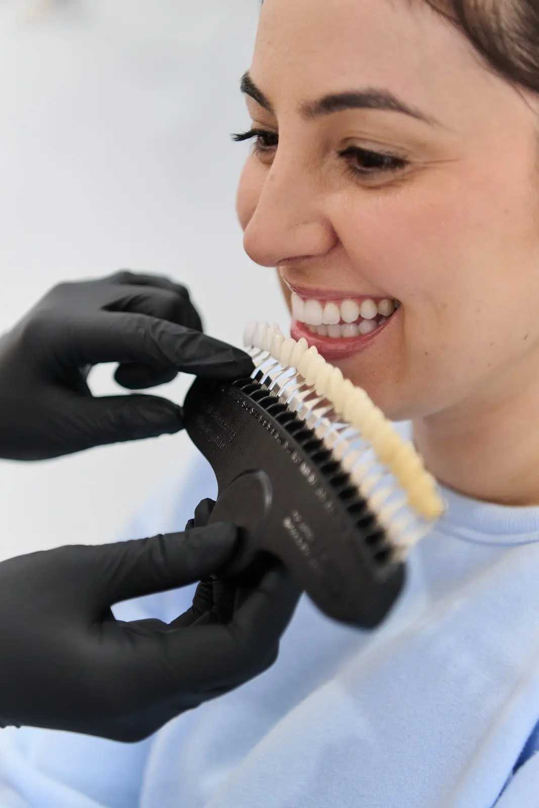 Dentist checking teeth shade during whitening treatment