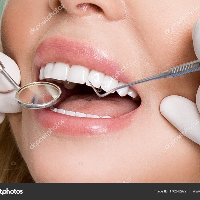Young beautiful woman with beautiful white teeth sitting on a dental chair. The dentist cures her teeth.